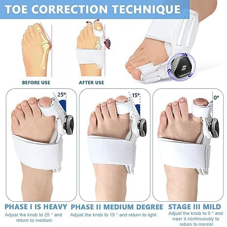 Bunion Corrector